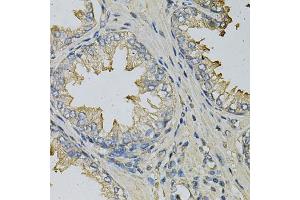 Immunohistochemistry of paraffin-embedded human prostate using LITAF Antibody (ABIN6130523, ABIN6143254, ABIN6143255 and ABIN6221131) at dilution of 1:100 (40x lens). (LITAF antibody  (AA 1-161))