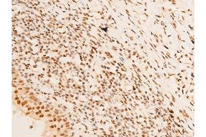 Immunohistochemistry (IHC) image for anti-serum/glucocorticoid Regulated Kinase 1 (SGK1) (pSer422) antibody (ABIN6256329)