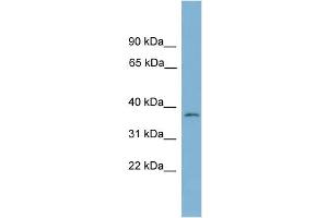 WB Suggested Anti-NUBP1 Antibody Titration: 0. (NUBP1 antibody  (Middle Region))