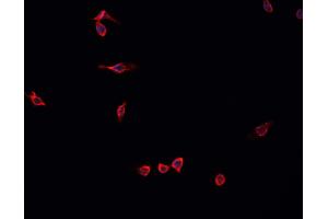 ABIN6268937 staining U-2 OS cells by IF/ICC. (MEF2C antibody  (C-Term))