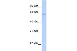 WB Suggested Anti-ARID5A Antibody Titration:  0. (ARID5A antibody  (N-Term))