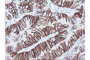 Image no. 6 for anti-FXYD Domain Containing Ion Transport Regulator 3 (FXYD3) antibody (ABIN1498341)