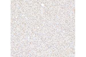 anti-Mediator Complex Subunit 1 (MED1) (C-Term) antibody
