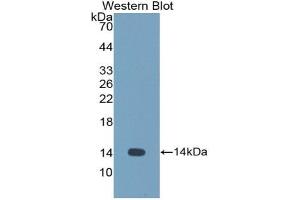 Detection of Recombinant CST1, Human using Polyclonal Antibody to Cystatin 1 (CST1) (CSTL1 antibody  (AA 21-114))