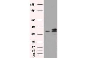 Image no. 2 for anti-Nucleoredoxin-Like 2 (NXNL2) antibody (ABIN1499887) (NXNL2 antibody)