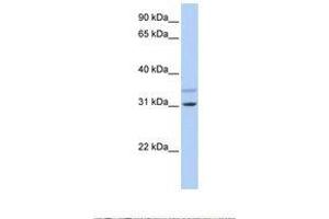 Image no. 1 for anti-Tripartite Motif Containing 13 (TRIM13) (AA 74-123) antibody (ABIN6737766) (TRIM13 antibody  (AA 74-123))