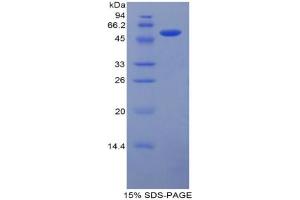 SDS-PAGE analysis of Mouse Laminin beta 1 Protein. (Laminin beta 1 Protein)