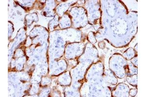 Formalin-fixed, paraffin-embedded human Placenta stained with PAPP-A Mouse Monoclonal Antibody (PAPPA/2715). (PAPPA antibody  (AA 351-523))