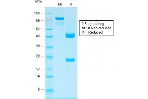 SDS-PAGE Analysis Purified IgG Rabbit Recombinant Monoclonal Antibody (IG1707R). (Recombinant IGHG antibody)