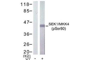 Image no. 2 for anti-Mitogen-Activated Protein Kinase Kinase 4 (MAP2K4) (pSer80) antibody (ABIN196910) (MAP2K4 antibody  (pSer80))