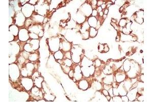 Mouse visceral fat tissue was stained by Rabbit Anti-Adiponutrin (436-481) (Human) Serum (PNPLA3 antibody  (AA 436-481))