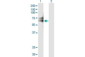 Western Blot analysis of IL18RAP expression in transfected 293T cell line by IL18RAP MaxPab polyclonal antibody. (IL18RAP antibody  (AA 1-599))
