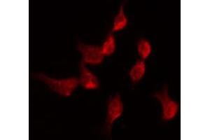 ABIN6274344 staining Hela by IF/ICC. (TDG antibody  (Internal Region))