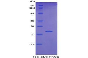 SDS-PAGE analysis of Mouse GCSFR Protein. (CSF3R Protein)