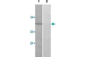 Western blot analysis of Lane 1: UV treated 3T3 cells, Lane 2: antigen-specific peptide treated 3T3 cells with PAK1 (phospho S204) polyclonal antibody  at 1:500-1000 dilution. (PAK1 antibody  (pSer204))
