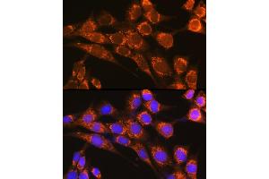 Immunofluorescence analysis of NIH-3T3 cells using CFP Rabbit pAb (ABIN6127651, ABIN6138467, ABIN6138468 and ABIN6221045) at dilution of 1:100 (40x lens). (CFP antibody  (AA 190-469))