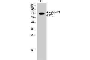 Western Blotting (WB) image for anti-X-Ray Repair Complementing Defective Repair in Chinese Hamster Cells 6 (XRCC6) (acLys331) antibody (ABIN3181899) (XRCC6 antibody  (acLys331))