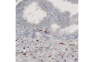 Immunohistochemical staining (Formalin-fixed paraffin-embedded sections) of human prostate with SLC6A2 monoclonal antibody, clone CL3063  shows strong immunoreactivity in sympathetic fibers.
