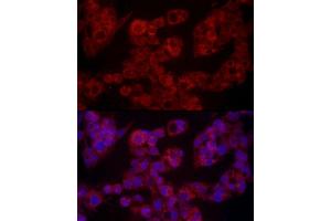 Immunofluorescence analysis of HepG2 cells using LEP Rabbit pAb (ABIN1513150, ABIN3021883, ABIN3021885 and ABIN6216821) at dilution of 1:100 (40x lens). (Leptin antibody  (AA 22-167))