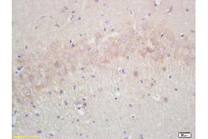 Formalin-fixed and paraffin embedded rat brain labeled with Rabbit Anti Annexin A13 Polyclonal Antibody, Unconjugated (ABIN671181) at 1:200 followed by conjugation to the secondary antibody and DAB staining (Aquaporin 4 antibody  (AA 271-323))