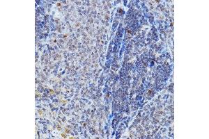 Immunohistochemistry of paraffin-embedded rat spleen using DGCR8 Rabbit pAb (ABIN7266761) at dilution of 1:200 (40x lens). (DGCR8 antibody)