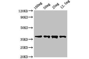 Western Blot Positive WB detected in Recombinant protein All lanes: DST antibody at 3. (Dystonin antibody  (AA 1-195))