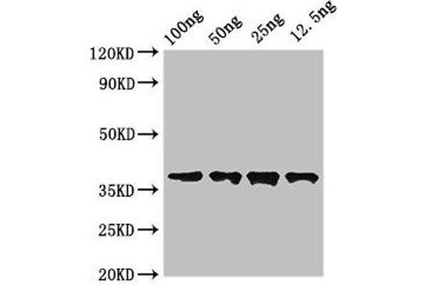Dystonin antibody  (AA 1-195)
