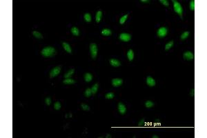 Immunofluorescence of purified MaxPab antibody to TTLL3 on HeLa cell. (TTLL3 antibody  (AA 1-101))