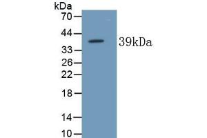 Detection of Recombinant ALPL, Human using Monoclonal Antibody to Alkaline Phosphatase, Tissue-nonspecific (ALPL) (ALPL antibody  (AA 18-335))