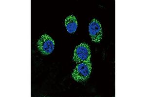 Confocal immunofluorescent analysis of RAGE Antibody (Center) (ABIN390897 and ABIN2841104) with MDA-M cell followed by Alexa Fluor 488-conjugated goat anti-rabbit lgG (green). (RAGE antibody  (AA 206-234))