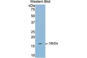 Western blot analysis of the recombinant protein. (COMP antibody  (AA 40-180))