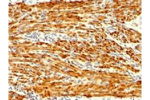 IHC testing of FFPE human uterus stained with recombinant Calponin antibody (clone CNN1/1408R). (Recombinant Calponin antibody)