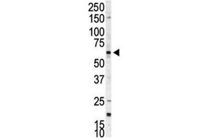 Western blot analysis of p70 S6 Kinase beta antibody and A375 cell lysate. (RPS6KB2 antibody  (AA 452-482))