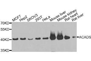 Western blot analysis of extracts of various cells, using ACADS antibody.