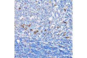 Immunohistochemistry of paraffin-embedded rat spleen using NDE1 antibody (ABIN5974277) at dilution of 1/100 (40x lens). (NDE1 antibody)