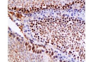 Formalin-fixed and paraffin embedded rat testis tissue (high fat) labeled with Anti-NPY/Neuropeptide Y Polyclonal Antibody, Unconjugated  at 1:200 followed by conjugation to the secondary antibody and DAB staining
