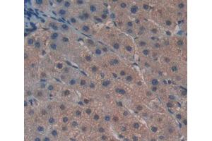Used in DAB staining on fromalin fixed paraffin- embedded liver tissue (GTF2H5 antibody  (AA 1-71))