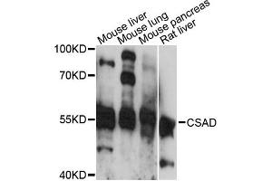Western blot analysis of extracts of various cell lines, using CSAD antibody (ABIN6294199) at 1:3000 dilution.
