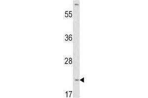 Western blot analysis of VHL antibody and HepG2 lysate. (VHL antibody  (AA 43-71))