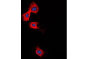 Immunofluorescent analysis of MMP11 staining in Raw264. (MMP11 antibody  (Center))