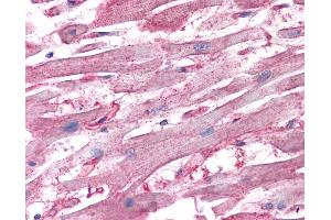 Anti-ATP6V1D antibody IHC of human heart. (ATP6V1D antibody  (AA 69-169))