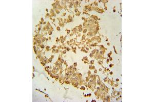 ZDHHC21 Antibody (N-term) (ABIN651365 and ABIN2840203) immunohistochemistry analysis in formalin fixed and paraffin embedded human testis tissue followed by peroxidase conjugation of the secondary antibody and DAB staining. (ZDHHC21 antibody  (N-Term))