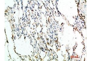 Immunohistochemical analysis of paraffin-embedded human-lung, antibody was diluted at 1:200