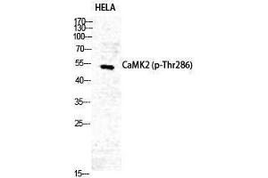 Western Blotting (WB) image for anti-CaMKIIalpha/delta (pThr286) antibody (ABIN3181941) (CaMKIIalpha/delta antibody  (pThr286))