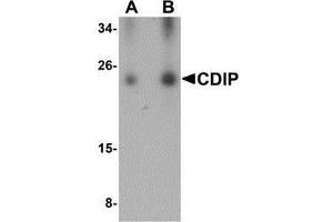 Western blot analysis of CDIP in human brain lysate with AP30220PU-N CDIP antibody at (A) 0. (CDIP1 antibody  (Center))
