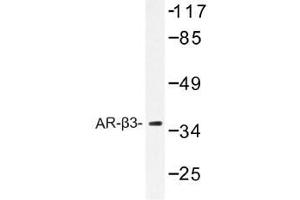 Image no. 1 for anti-Adrenergic, beta-3-, Receptor (ADRB3) antibody (ABIN317855)