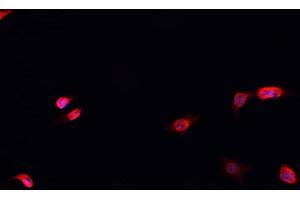 ABIN6266483 staining MCF-7 cells by IF/ICC. (HNRNPD/AUF1 antibody  (Internal Region))
