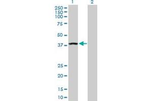 Western Blot analysis of ANKRA2 expression in transfected 293T cell line by ANKRA2 MaxPab polyclonal antibody. (ANKRA2 antibody  (AA 1-313))