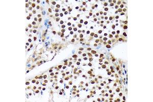 Immunohistochemistry of paraffin-embedded rat testis using PRP19 Rabbit mAb (ABIN7269505) at dilution of 1:100 (40x lens). (PRP19 antibody)