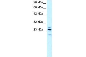 WB Suggested Anti-RGS20 Antibody Titration:  2. (RGS20 antibody  (Middle Region))